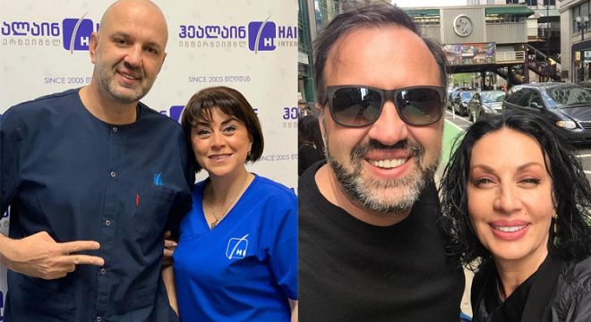 როგორ გამოიყურება მამულიჩა დღეს, რომელმაც რამდენიმე თვის წინ თმები გადაინერგა?