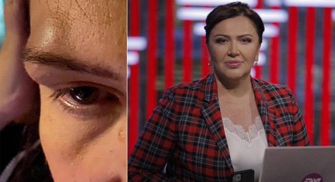 "საოცარი საღამო მქონდა უშველებელი კოპით და დალურჯებული თვალით დავრჩი..." ინგა გრიგოლია შემაშფოთებელ ფოტოსურათს აქვეყნებს