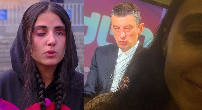 რა ფოტოსურათს აქვეყნებს მაკო გომური გახარიას ინტერვიუს პარალელურად