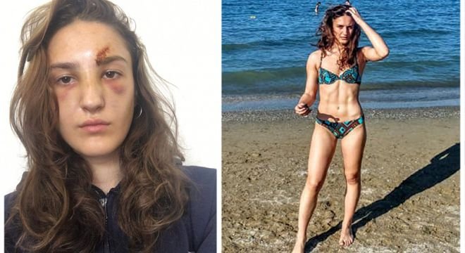 ვინ არის 17 წლის ქალრთველი გოგონა, რომელსაც უცხოეთში სისხლიან ფერიას ეძახიან