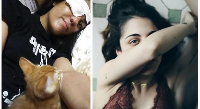 რას წერს მაკო გომური თვალის დაკარგვის შემდეგ პირველად სოციალურ ქსელში