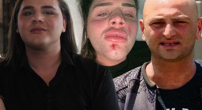 უბრალოდ მინდა გვერდით დამიდგეთ, სამი ადამიანი მირტყამდა გამეტებით... მითხრეს ეს მავანისგანო... რაუნდა ჩემგან ამ ადამიანს რას მერჩის