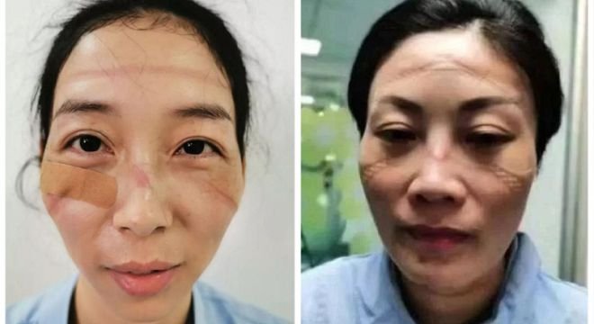 როგორ გამოიყურებიან ჩინელი მედიკოსები, რომლებიც კორონავირუსს ებრძვიან