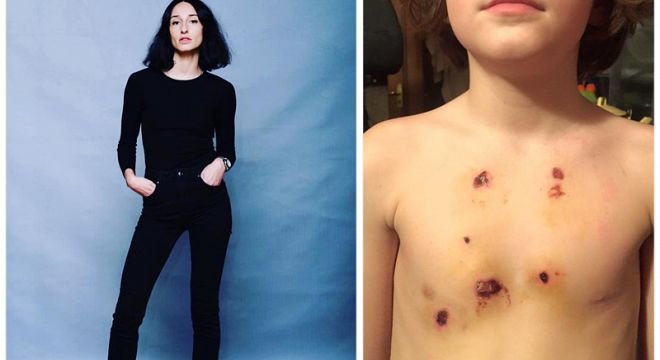 "საშინელეებააა! ჩემმა ძმამ თავი აიფეთქა..." - რუსკა მაყაშვილის ძმამ თავი აიფეთქა