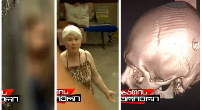 ექსკლუზიური ჩანაწერი - "აქცის მონაწილეს ტყვია მიბჯენით თავში ესროლეს, მომაკვდავი გადამალეს, არჩილ თალაკვაძის ძმა საავადმყოფოსთან დარაჯობდა რომ ინფორმაციას არ გაეჟონა,  ახლა კი ოჯახს ატერორებენ რომ ხმა არ ამოიღონ"