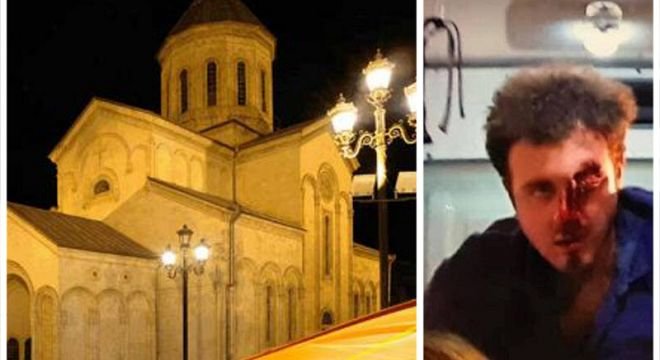 ამ წუთებში საპატრიარქო თბილისში ხალხის დასახიჩრებასთან დაკავშირებით საგანგებო განცხადებას ავრცელებს