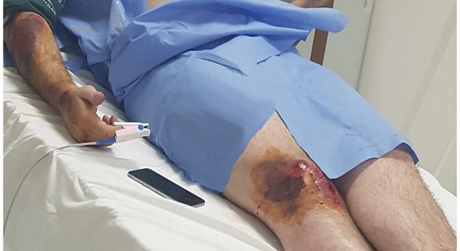 "იმ პრადოს მძღოლს მინდა ვუთხრა, შენით გამოჩნდი ჯობია, მაინც ამოგიღებ მიწიდან!"