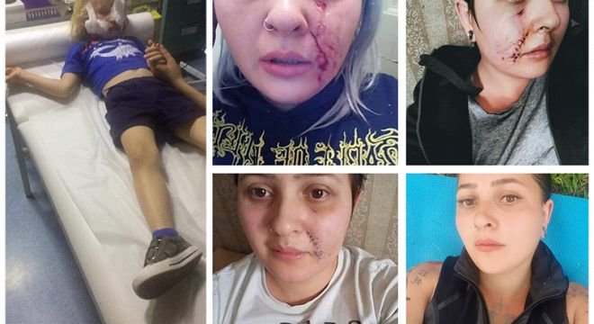 "მეგობრებო თუ ვინმე იცნობთ პეკინზე დაჭრილი ბავშვის მშობლებს ან ახლობლებს ეს ჩემი შედეგია... დამავალებთ თუ გაავრცელებთ..."