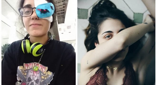 "მოკლედ,წავედით მე და ჩიემი თვალუკა იევროპებში... პ.ს ყურსასმენები გასაწმენდი არაა, სისხლი არ მოშორდა " - გოგონა, რომელიც 20 ივნისის ღამეს თვალი დაკარგა ევროპაში წავიდა