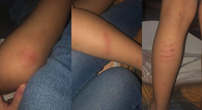 "ვიცი, რომ ბევრი უსამართლობა ხდება ყოველ დღე. მაგრამ ახლა ეს უსამართლობა ძალიან მოქმედებს... დაეჯახა, ზედ გადაუარა, უკანაც არ მოიხედა და გაიქცა..."