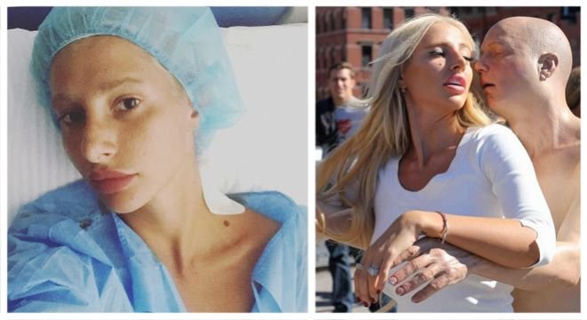 "ყველაფერი დაგლეჯილი მაქვს, აი სულ ყველაფერი... არაფერი არ მეშველება" - ნუკი კოშკელიშვილი სერიოზულად დაშავდა