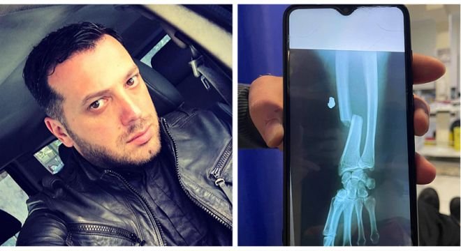 "ავარიაში მოვყევი... ეს ჩემი ხელია. ილოცეთ... ტკივილს ვერ ვუძლებ!" - მამა პეტრე საოპერაციოდ შეჰყავთ