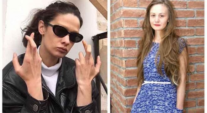 ჩცდ-სმსახიობი ქალების შიშველი ფოტოსესია გაუპარსავი იღლიებით - რატომ გაიხადეს ცნობილმა მსახიობებმა