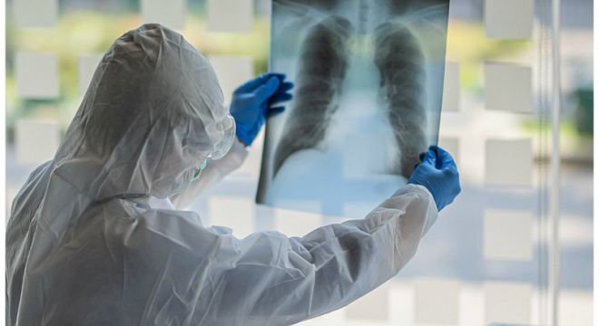 რა კვალს ტოვებს კოვიდ 19 ადამიანის ორგანიზმში და რა შეიძლება დაემართოთ მომავალში ინფექცია გადატანილ ადამიანებს