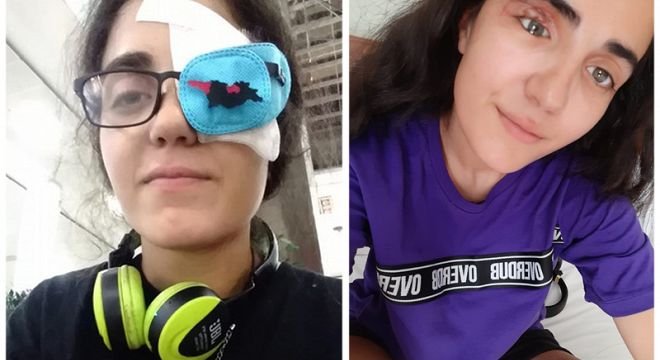 "მე და ახალი თვალი, ეს შრამი რომ არა არც ეტყობა რომ ხელოვნური თვალია არა" - როგორ გამოიყურება მაკო გომურის ახალი თვალი