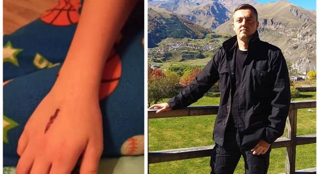 "დღეს აღმოვუჩინე ჩემს შვილს ეს ნაიარევი, ვკითხე საიდან ჰქონდა და ყველაფერი მომიყვა..." - გაფრთხილება მშობლებს, ინტერნეტში ახალი თამაში გამოჩნდა