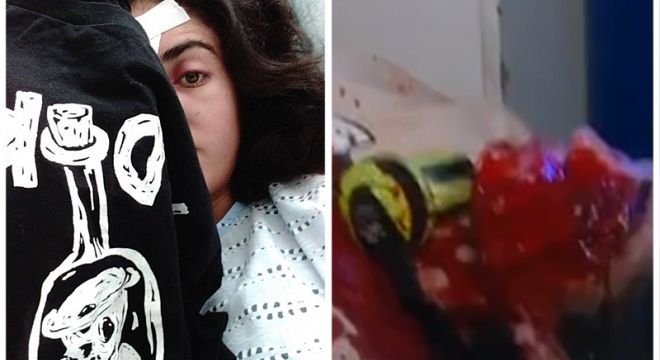 ეს არის 19 წლის მაკო გომური ოპერაციის შემდეგ, გოგონა, რომელმაც აქციის დარბევის დროს თვალი დაკარგა...