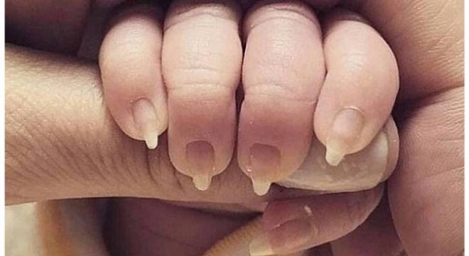 მშობლებმა ჩვილ ბავშვს ფრჩხილები გაუზარდეს და მანიკური წაუსვეს