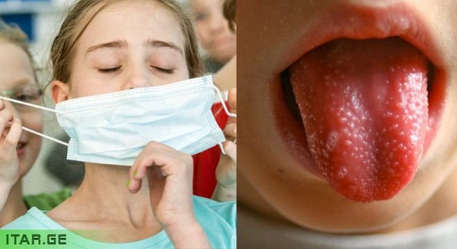 ბი-ბი-სი-ს ინფორმაციით ბავშვებში გამოვლენილი ახალი სინდრომი კორონა ვირუსს უკავშირდება - რა სინდრომია ეს და არის თუ არა საშიში ბავშვის განვითარებისთვის