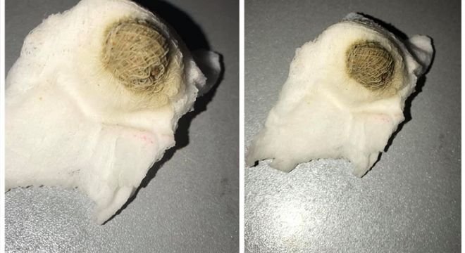 "ბოდიში ასეთი უხერხული ფოტოსთვის, ვიცი ძალიან უსიამოვნოა, მაგრამ ყველა თქვენგანმა აუცილებლად უნდა იცოდეს!"