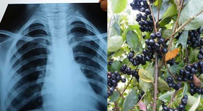 გერმანელი მეცნიერების სენსაციური მიგნება - დასახელდა ბუნებრივი პროდუქტი, რომელიც კორონა ვირუსის ნაწილაკებს ანადგურებს