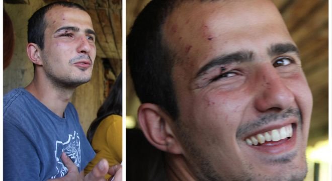 "ჩემს დაბადების დღეზე თანამშრომლებმა სტრიპტიზიორი ბიჭი მომიყვანეს... ცოტა ხანში სანდრო დასისხლიანებული შემოვიდა და მეუბნება, სენმა ძმამ მცემაო..." - რას ყვებიან მეგობრები ოპერატორზე, რომელმაც თავი მოიკლა