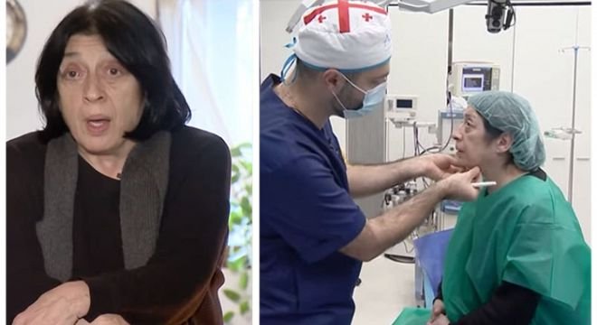 ირინა სარიშვილის საოცარი გარდასახვა - როგორ გამოიყურება პოლიტიკოსი დღეს, ბოტოქსის გაკეთების შემდეგ?