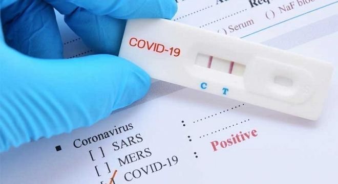 ვირუსის დადასტურებული შემთხვევებით საქართველომ ჩინეთს გაუსწრო