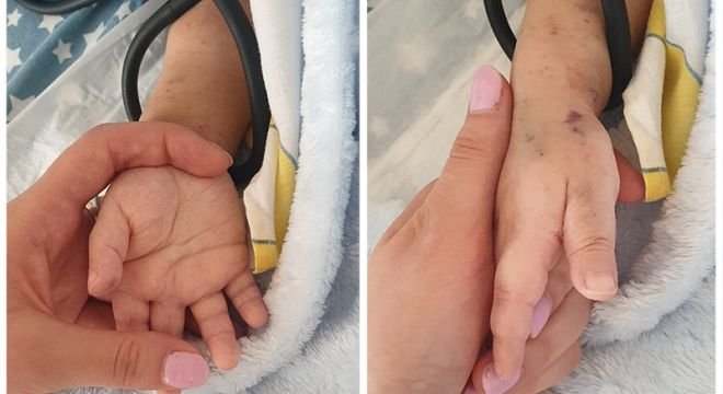 "შენი დაჩხვლეტილი და დაჭმუჭნული ხელები მტკივა.... შენი სამივე ღია ჭრილობა მტკივა... სული მტკივა შენი ტანჯვით...."