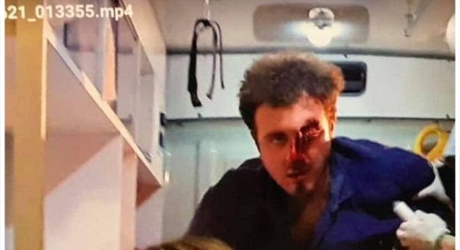 "ახალგაზრდა ბიჭმა და გოგომ დაკარგეს თვალი თავისუფალ ქვეყანაში... საპროტესტო აქციაზე წავიდნენ და თვალის გარეშე დაბრუნდნენ"