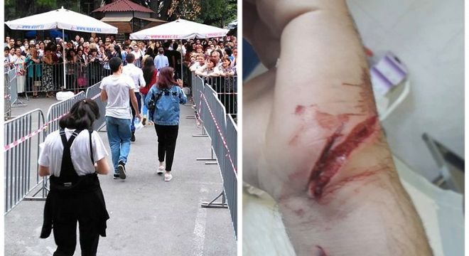 მავთულხლართებზე დასერილი ხელები და ნაკერები - როგორ იპარებიან აბიტურიენტები გალიდან იმის გამო რომ ეროვნული გამოცდები ჩააბარონ