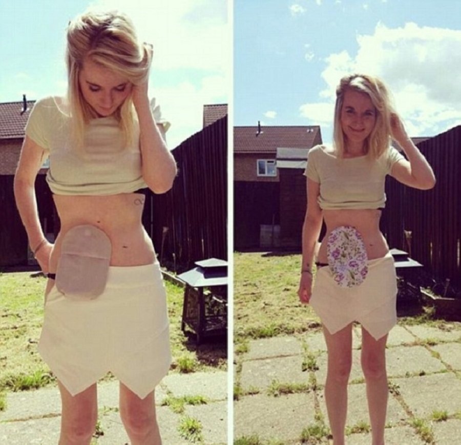 ის აუზში დაცურავდა, როდესაც ვიღაცამ მის მუცელზე ტომარა შენიშნა - რაც შემდეგ მოხდა არავინ მოელოდა ამას...